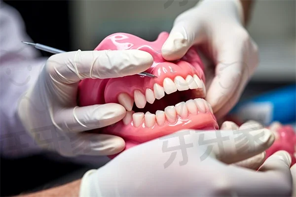 石家庄全博口腔（蜂巢儿牙中心门诊）烤瓷牙现优惠仅需2500元起，原价3000元起，超值选择，确实不容错过！