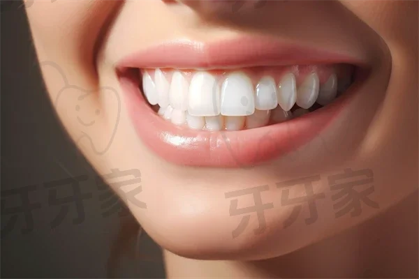 海口牙科医院排名前五，唯笑齿科补牙项目专業可靠，值得信赖的选择